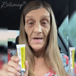 𝑶𝒇𝒇𝒊𝒄𝒊𝒂𝒍 𝑺𝒕𝒐𝒓𝒆👍| Regain youthful skin nown 💫STDEI® BOTOX & VITA A RETINOL SHOT Wrinkle Lift Tightening Cream