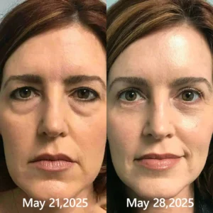 𝑶𝒇𝒇𝒊𝒄𝒊𝒂𝒍 𝑺𝒕𝒐𝒓𝒆👍| Regain youthful skin nown 💫STDEI® BOTOX & VITA A RETINOL SHOT Wrinkle Lift Tightening Cream