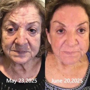 𝑶𝒇𝒇𝒊𝒄𝒊𝒂𝒍 𝑺𝒕𝒐𝒓𝒆👍| Regain youthful skin nown 💫STDEI® BOTOX & VITA A RETINOL SHOT Wrinkle Lift Tightening Cream