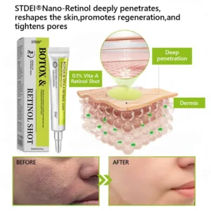 𝑶𝒇𝒇𝒊𝒄𝒊𝒂𝒍 𝑺𝒕𝒐𝒓𝒆👍| Regain youthful skin nown 💫STDEI® BOTOX & VITA A RETINOL SHOT Wrinkle Lift Tightening Cream