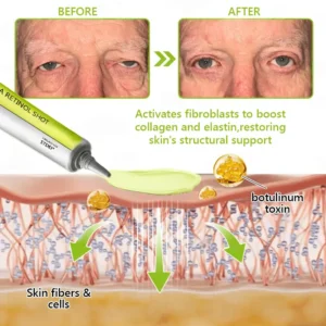 𝑶𝒇𝒇𝒊𝒄𝒊𝒂𝒍 𝑺𝒕𝒐𝒓𝒆👍| Regain youthful skin nown 💫STDEI® BOTOX & VITA A RETINOL SHOT Wrinkle Lift Tightening Cream