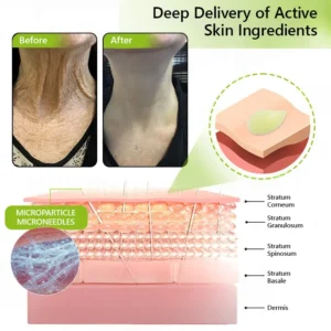 𝑶𝒇𝒇𝒊𝒄𝒊𝒂𝒍 𝑺𝒕𝒐𝒓𝒆👍| Regain youthful skin nown 💫STDEI® BOTOX & VITA A RETINOL SHOT Wrinkle Lift Tightening Cream