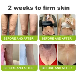 👏🌿 Made in the USA  direct shipping 💫KLENIMORE™ Botox Vitamin A Retinol Anti-Wrinkle Firming and Lifting Cream — Last Day for Limited Time 70% OFF