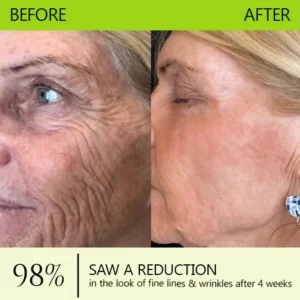 [🔥Last Day 70% OFF] ODALIT™ Botox & Retinol Shot - Eraser for Deep Wrinkles, Sagging Jowls & Puffy Eyes
