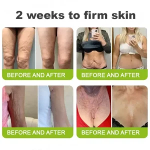 👨‍⚕️Made and shipped from Australia💫 Botox & Vita-A Retinol Shot Wrinkle-Lift Tightening cream - Last Day Promotion 70% OFF