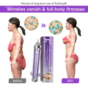 NAD+ Retinol Firming & Lifting Cream(30ml) – For Eye Bags, Dark Circles & Fine Lines | Last Day Sale: 50% OFF