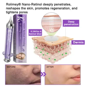 NAD+ Retinol Firming & Lifting Cream(30ml) – For Eye Bags, Dark Circles & Fine Lines | Last Day Sale: 50% OFF