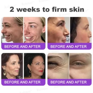 NAD+ Retinol Firming & Lifting Cream(30ml) – For Eye Bags, Dark Circles & Fine Lines | Last Day Sale: 50% OFF