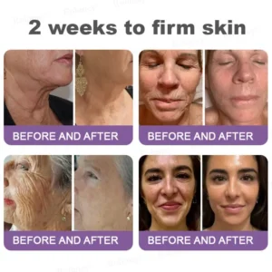 NAD+ Retinol Firming & Lifting Cream(30ml) – For Eye Bags, Dark Circles & Fine Lines | Last Day Sale: 50% OFF