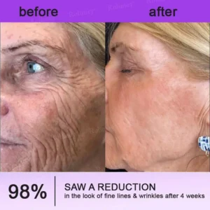 NAD+ Retinol Firming & Lifting Cream(30ml) – For Eye Bags, Dark Circles & Fine Lines | Last Day Sale: 50% OFF