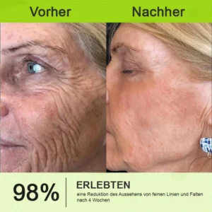 Now regain youthful skin. 💫👨‍⚕️ NESLEMY ™ Wrinkle relaxer & Vita-A Retinol Shot Wrinkle Lift Firming Cream