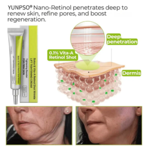 Yunpso® Advanced Peptide Botox-Style Vita-A Retinol Lifting Renewal Cream Today Only 70 OFF
