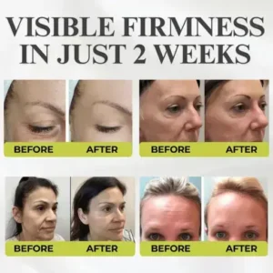 Yunpso® Botox Vita-A Retinol Shot Wrinkle-Lift Tightening cream – Last Day Promotion 70 OFF