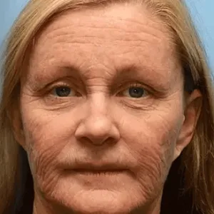 𝑶𝒇𝒇𝒊𝒄𝒊𝒂𝒍 𝑺𝒕𝒐𝒓𝒆👍| BUY 1 GET 1 FREE!!!Regain youthful skin nown 💫STDEI® BOTOX & VITA A RETINOL SHOT Wrinkle Lift Tightening Cream