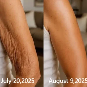 𝑶𝒇𝒇𝒊𝒄𝒊𝒂𝒍 𝑺𝒕𝒐𝒓𝒆👍| BUY 1 GET 1 FREE!!!Regain youthful skin nown 💫STDEI® BOTOX & VITA A RETINOL SHOT Wrinkle Lift Tightening Cream