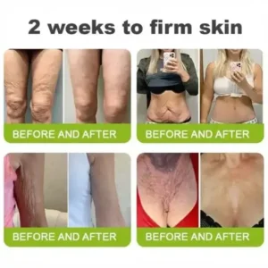 LOVILDS® moringa Vita-A Retinol Shot Wrinkle-Lift Tightening cream – Last Day Promotion 50 OFF