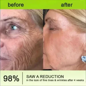 Lovilds® Botin Vita-A Retinol Shot Wrinkle-Lift Tightening cream – Last Day Promotion 70 OFF