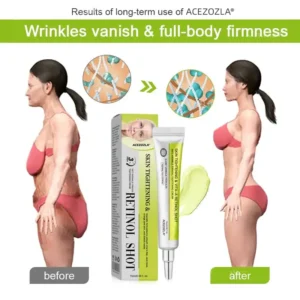 🧠👨‍⚕️Made and shipped from the USA 💫ACEZOZLA® Skin Tightening & Vita-A Retinol Retinol shot Anti-Wrinkle Firming Tightening cream - Last Day Promotion 70% OFF