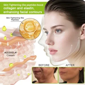 🧠👨‍⚕️Made and shipped from the USA 💫ACEZOZLA® Skin Tightening & Vita-A Retinol Retinol shot Anti-Wrinkle Firming Tightening cream - Last Day Promotion 70% OFF