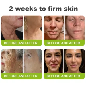 👏🌿Made and shipped from the USA 💫KLENIMORE™ Botox & Vita-A Retinol Shot Wrinkle-Lift Tightening cream - Last Day Promotion 70% OFF