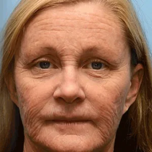 🔥Final 3 Hours: 70%OFF🔥 Botulinum & Vita-A Retinol Shot Wrinkle-Lift Tightening cream✨