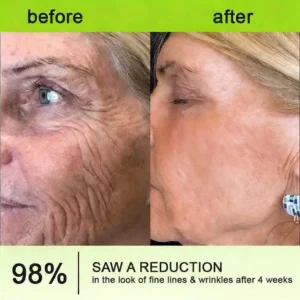 👨‍⚕️Made and shipped from the USA 💫LOVILDS® moringa & Vita-A Retinol Shot Wrinkle-Lift Tightening cream -Last Day Promotion 70% OFF