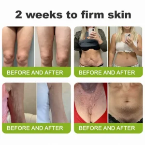 🧠👨‍⚕️Made and shipped from the USA 💫Purviona™ Botin & Vita-A Retinol Shot Wrinkle-Lift Tightening cream - Last Day Promotion 70% OFF