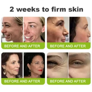🇺🇸 𝑶𝒇𝒇𝒊𝒄𝒊𝒂𝒍 𝑺𝒕𝒐𝒓𝒆 👨‍⚕️| 𝑳𝑶𝑽𝑰𝑳𝑫𝑺® 𝑺𝒌𝒊𝒏 𝑻𝒊𝒈𝒉𝒕𝒆𝒏𝒊𝒏𝒈 & 𝑽𝒊𝒕𝒂-𝑨 𝑹𝒆𝒕𝒊𝒏𝒐𝒍 𝑹𝒆𝒕𝒊𝒏𝒐𝒍 𝑺𝒉𝒐𝒕 𝑨𝒏𝒕𝒊-𝑾𝒓𝒊𝒏𝒌𝒍𝒆 𝑭𝒊𝒓𝒎𝒊𝒏𝒈 𝑻𝒊𝒈𝒉𝒕𝒆𝒏𝒊𝒏𝒈 𝑪𝒓𝒆𝒂𝒎 💫 - 𝑳𝒂𝒔𝒕 𝑫𝒂𝒚 𝑷𝒓𝒐𝒎𝒐𝒕𝒊𝒐𝒏 70% 𝑶𝑭𝑭
