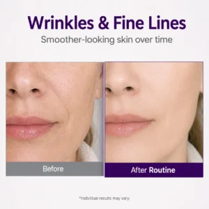 💜 NESLEMY Retinol + Retinal NAD+ Firming Serum – Smoother, Firmer & Younger-Looking Skin ✨
