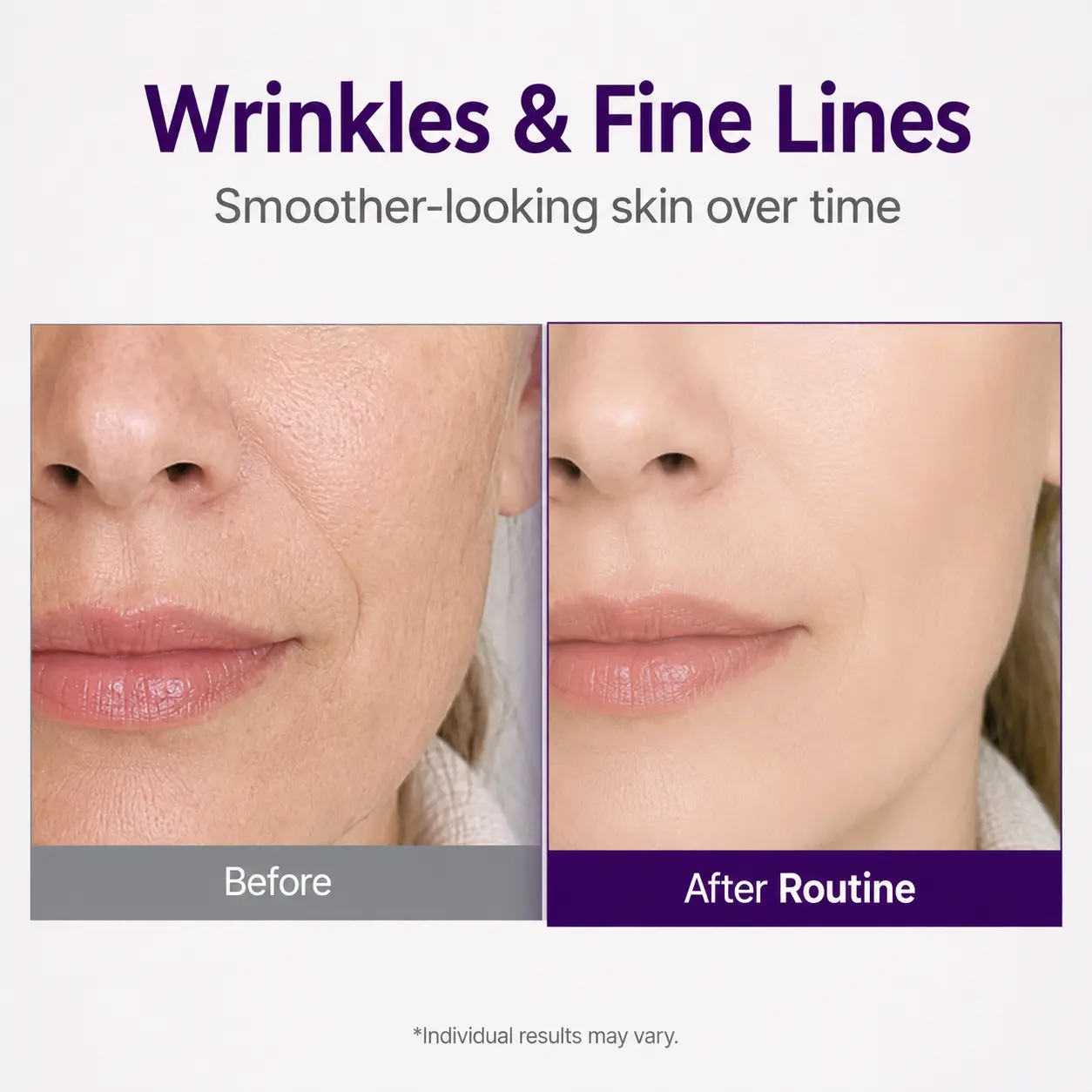 💜 NESLEMY Retinol + Retinal NAD+ Firming Serum – Smoother, Firmer & Younger-Looking Skin ✨