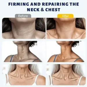 5-Ball Roller Neck Firming Cream with Retinol & Hyaluronic Acid