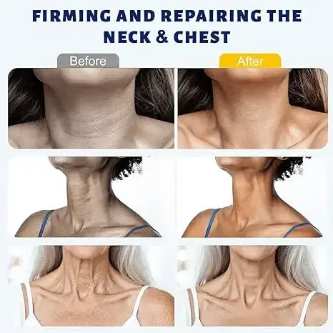 5-Ball Roller Neck Firming Cream with Retinol & Hyaluronic Acid