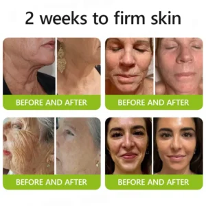 Femscoop™ Botox & Retinol Shot