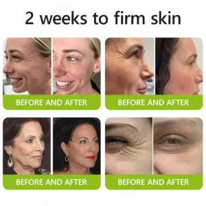 Femscoop™ Botox & Retinol Shot
