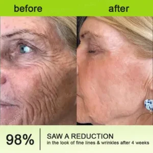 👩⚕️
🏆
Made and shipped from the Canada
Made & shipped from Canada
💫
Celestvéra®
Botox & Vita-A Retinol Shot Wrinkle-Lift Tightening Cream
🔥Last Day Promotion
70% OFF