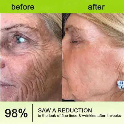 👩⚕️
🏆
Made and shipped from the Canada
Made & shipped from Canada
💫
Celestvéra®
Botox & Vita-A Retinol Shot Wrinkle-Lift Tightening Cream
🔥Last Day Promotion
70% OFF