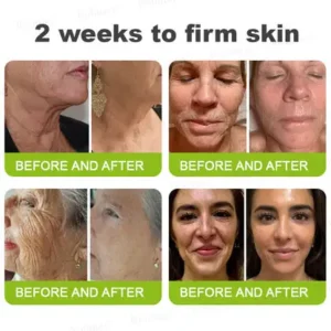 👩⚕️
🏆
Made and shipped from the Canada
Made & shipped from Canada
💫
Celestvéra®
Botox & Vita-A Retinol Shot Wrinkle-Lift Tightening Cream
🔥Last Day Promotion
70% OFF