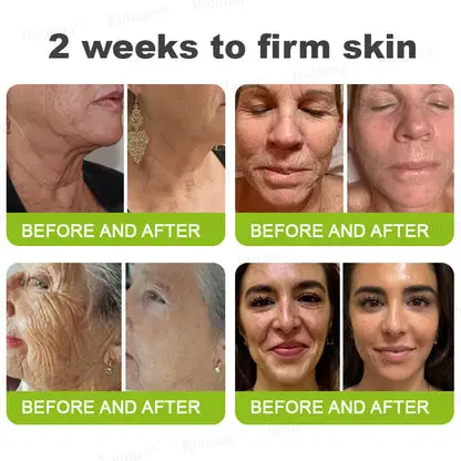 👩⚕️
🏆
Made and shipped from the Canada
Made & shipped from Canada
💫
Celestvéra®
Botox & Vita-A Retinol Shot Wrinkle-Lift Tightening Cream
🔥Last Day Promotion
70% OFF