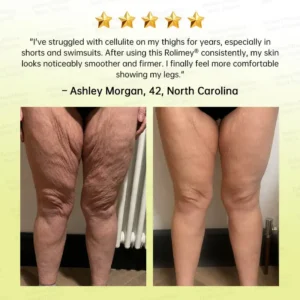 👩⚕️
Made and shipped from USA
Made & shipped from USA
💫
Rolimey® Botox & Multi-Peptide Retinol Shot Wrinkle-Lift Tightening Cream
Last Day Promotion
70% OFF