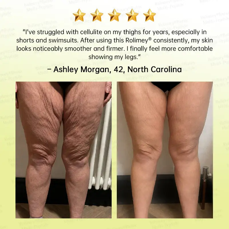 👩⚕️
Made and shipped from USA
Made & shipped from USA
💫
Rolimey® Botox & Multi-Peptide Retinol Shot Wrinkle-Lift Tightening Cream
Last Day Promotion
70% OFF