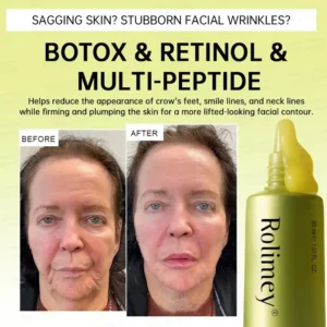 👩⚕️
Made and shipped from USA
Made & shipped from USA
💫
Rolimey® Botox & Multi-Peptide Retinol Shot Wrinkle-Lift Tightening Cream
Last Day Promotion
70% OFF