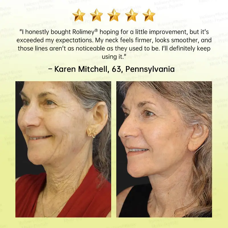 👩⚕️
Made and shipped from USA
Made & shipped from USA
💫
Rolimey® Botox & Multi-Peptide Retinol Shot Wrinkle-Lift Tightening Cream
Last Day Promotion
70% OFF