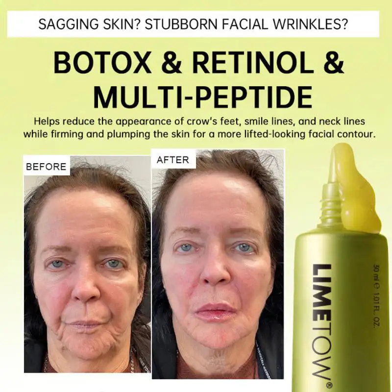 🏅💧💐LIMETOW® Multi-Peptide Retinol Shot Wrinkle-Lift Cream