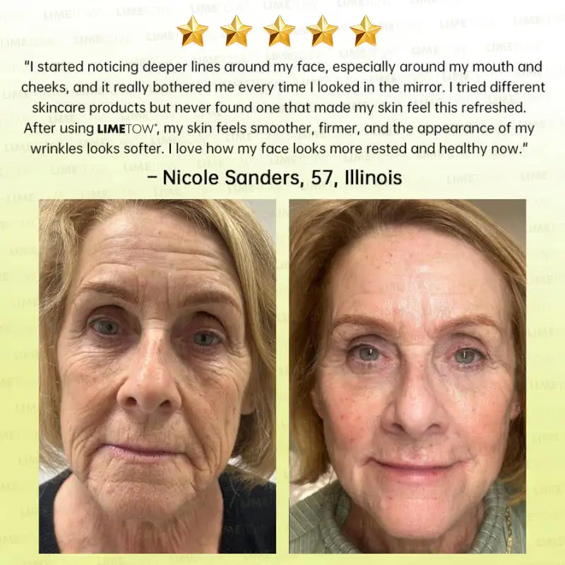 🏅💧💐LIMETOW® Multi-Peptide Retinol Shot Wrinkle-Lift Cream