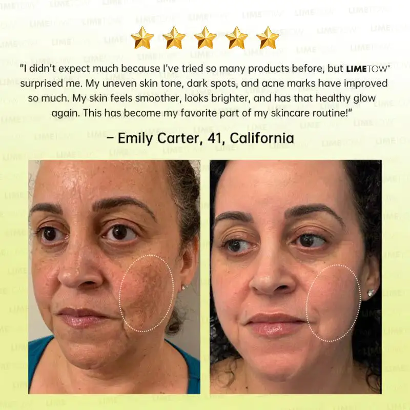 🏅💧💐LIMETOW® Multi-Peptide Retinol Shot Wrinkle-Lift Cream