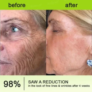 Official Store 🇺🇸|❤️Rolimey® Botox & Vita-A Retinol Shot Wrinkle-Lift Tightening cream - Last Day Promotion 50% OFF