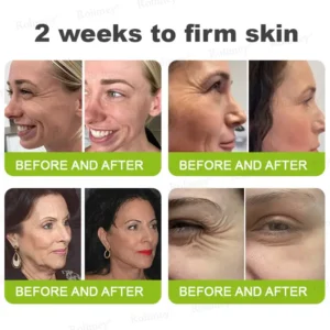 Official Store 🇺🇸|❤️Rolimey® Botox & Vita-A Retinol Shot Wrinkle-Lift Tightening cream - Last Day Promotion 50% OFF